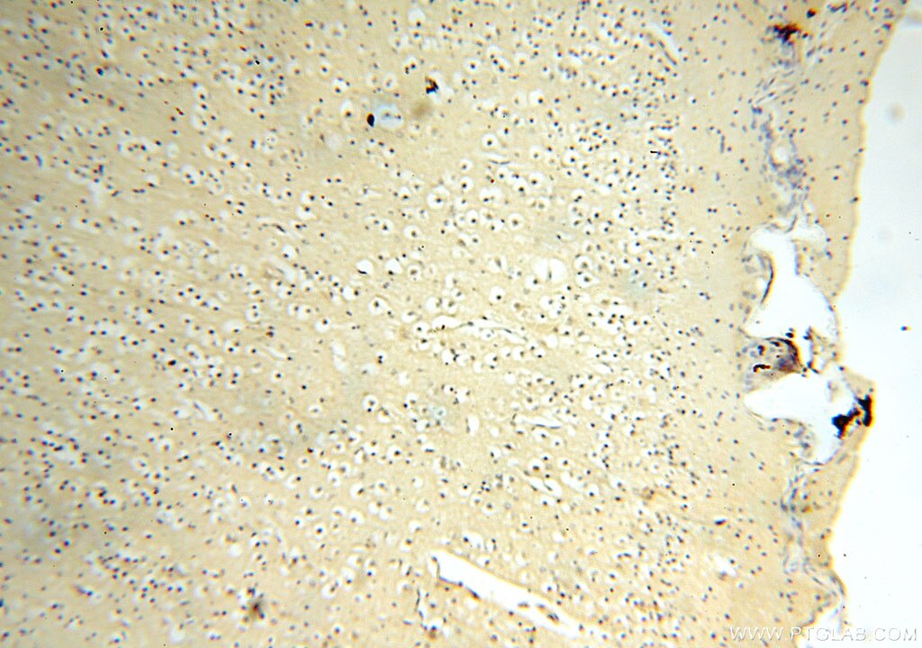 Immunohistochemistry (IHC) staining of human brain tissue using Surfactant Protein A Polyclonal antibody (11850-1-AP)