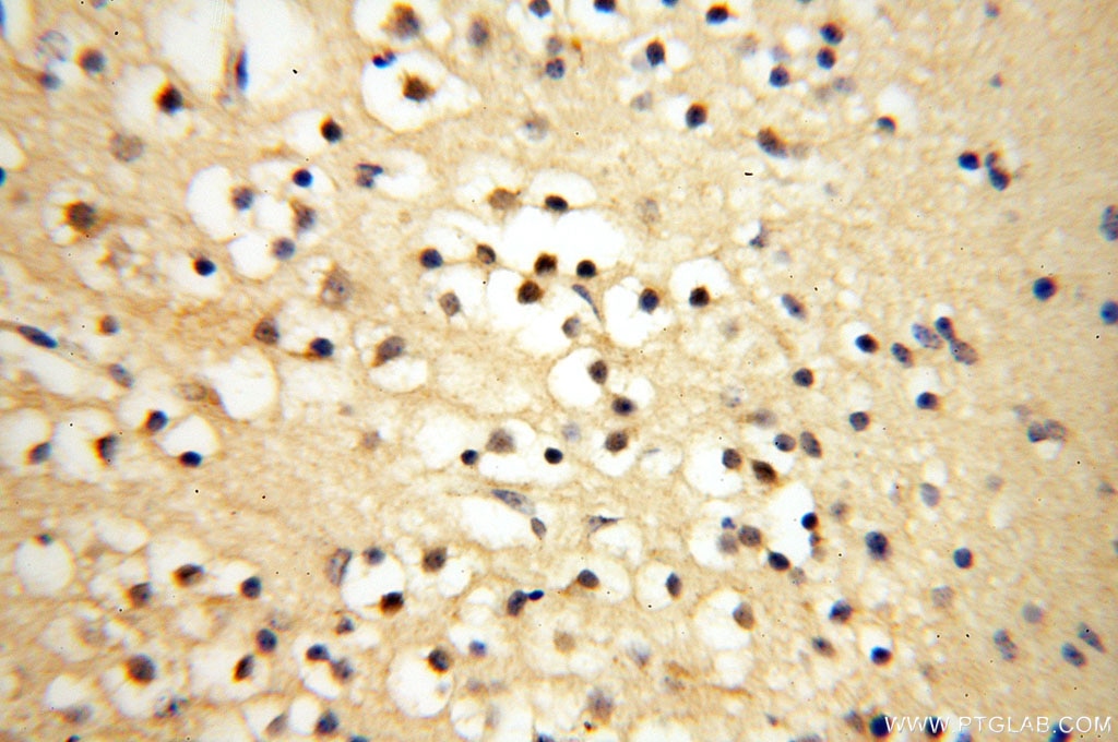 Immunohistochemistry (IHC) staining of human brain tissue using Surfactant Protein A Polyclonal antibody (11850-1-AP)