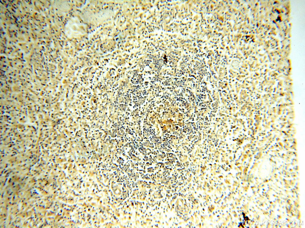 IHC staining of human spleen using 11850-1-AP