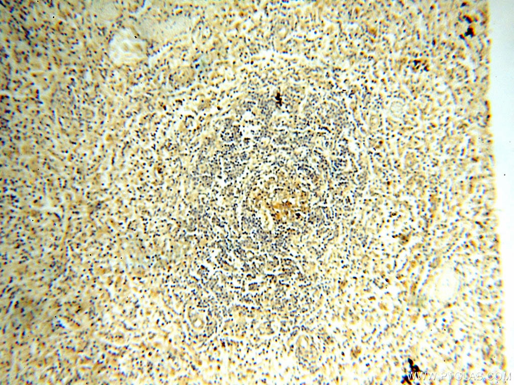 Immunohistochemistry (IHC) staining of human spleen tissue using Surfactant Protein A Polyclonal antibody (11850-1-AP)