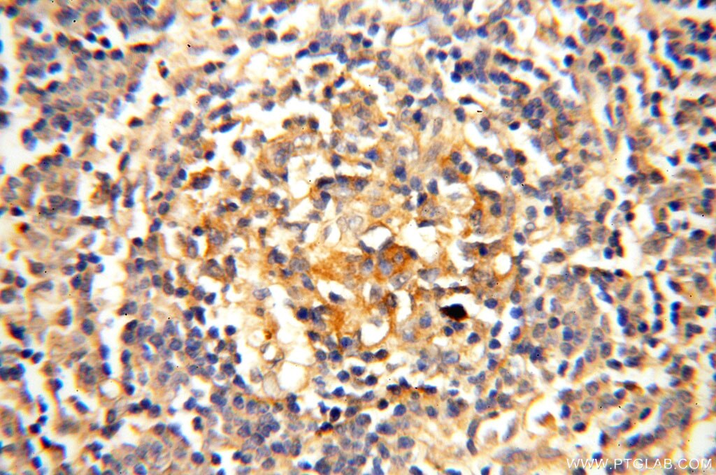 Immunohistochemistry (IHC) staining of human spleen tissue using Surfactant Protein A Polyclonal antibody (11850-1-AP)