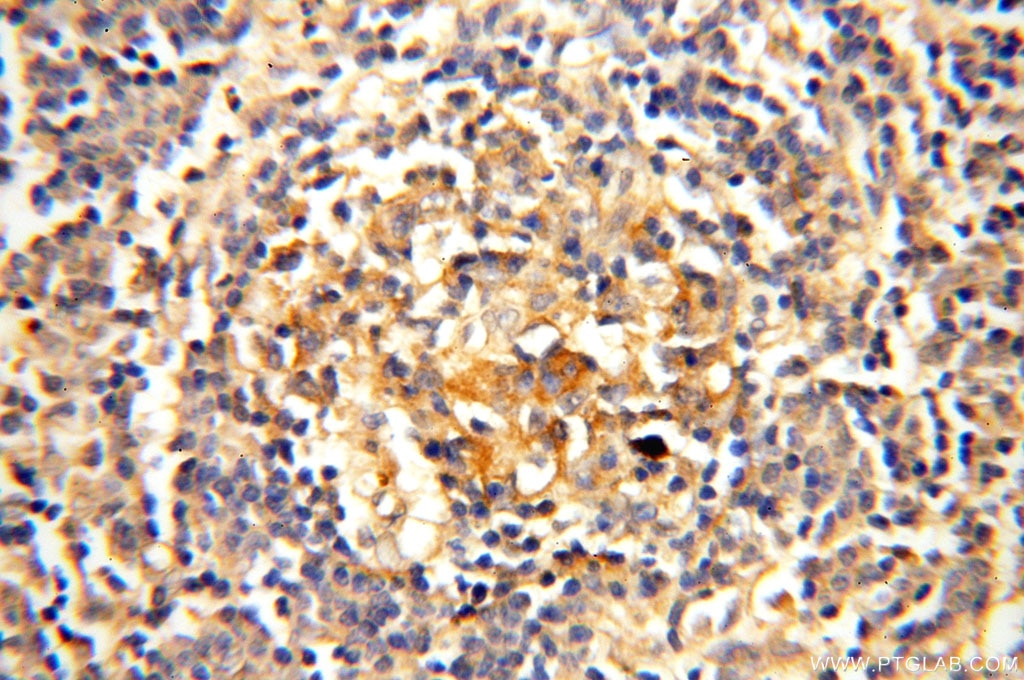 Immunohistochemistry (IHC) staining of human spleen tissue using Surfactant Protein A Polyclonal antibody (11850-1-AP)