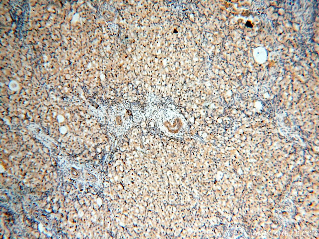 Immunohistochemistry (IHC) staining of human ovary tissue using Surfactant Protein A Polyclonal antibody (11850-1-AP)