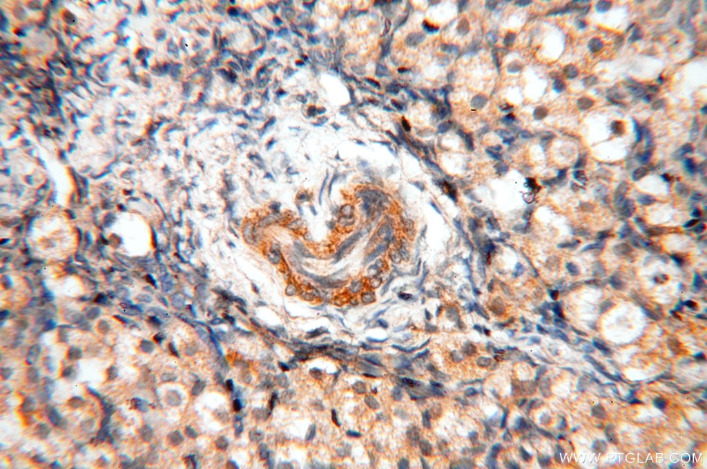 Immunohistochemistry (IHC) staining of human ovary tissue using Surfactant Protein A Polyclonal antibody (11850-1-AP)