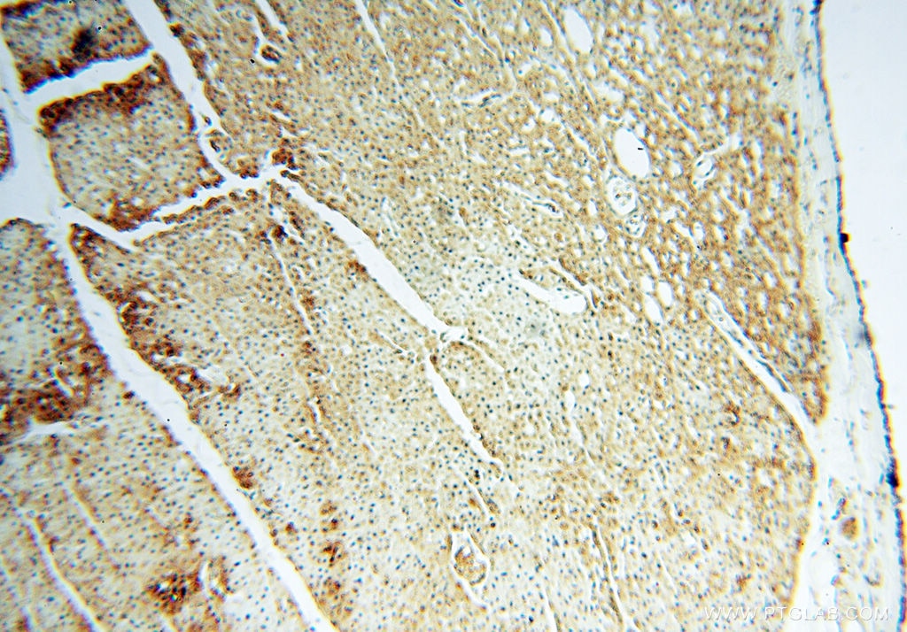 Immunohistochemistry (IHC) staining of human heart tissue using SFTPB Polyclonal antibody (13664-1-AP)