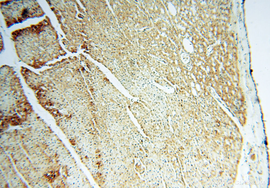 IHC staining of human heart using 13664-1-AP