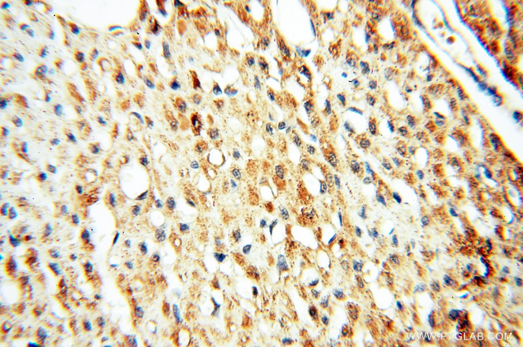 IHC staining of human heart using 13664-1-AP