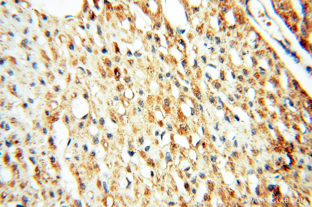 Immunohistochemistry (IHC) staining of human heart tissue using SFTPB Polyclonal antibody (13664-1-AP)