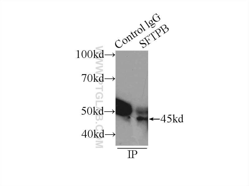 Immunoprecipitation (IP) experiment of Y79 cells using SFTPB Polyclonal antibody (13664-1-AP)