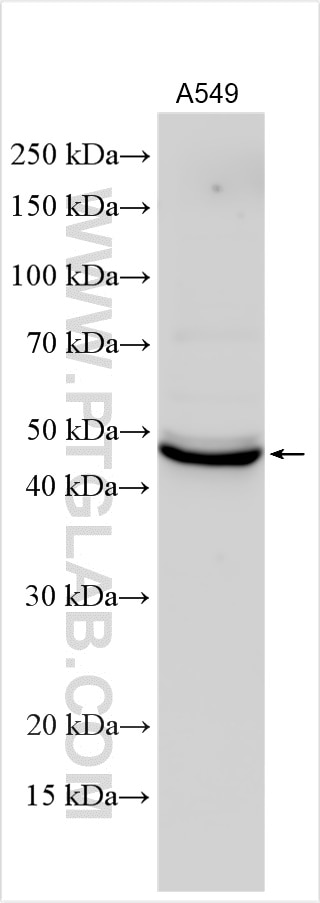 Western Blot (WB) analysis of A549 cells using SFTPB Polyclonal antibody (13664-1-AP)