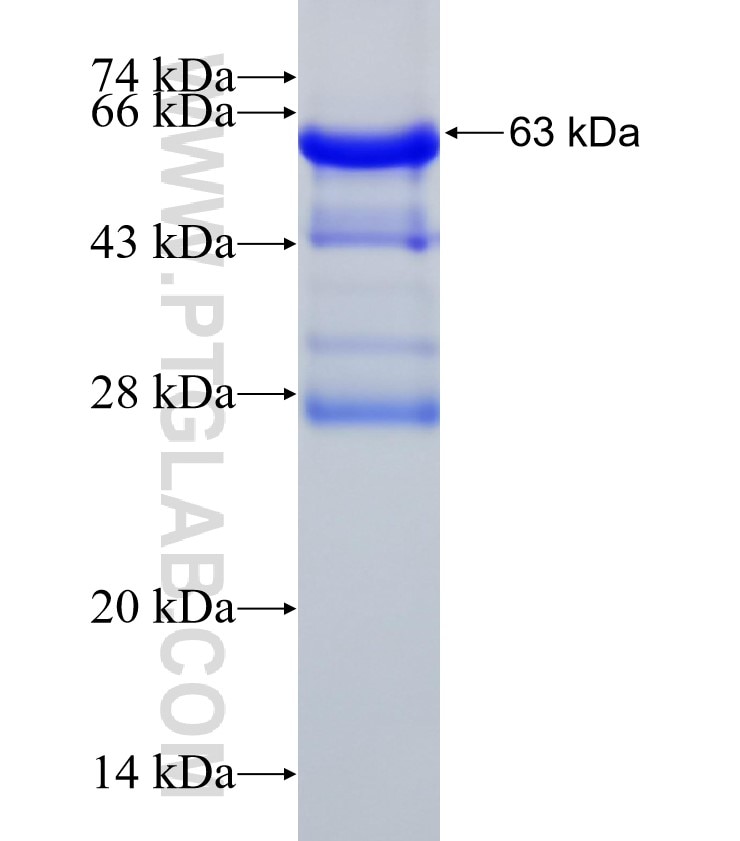 SFTPB fusion protein Ag4576 SDS-PAGE