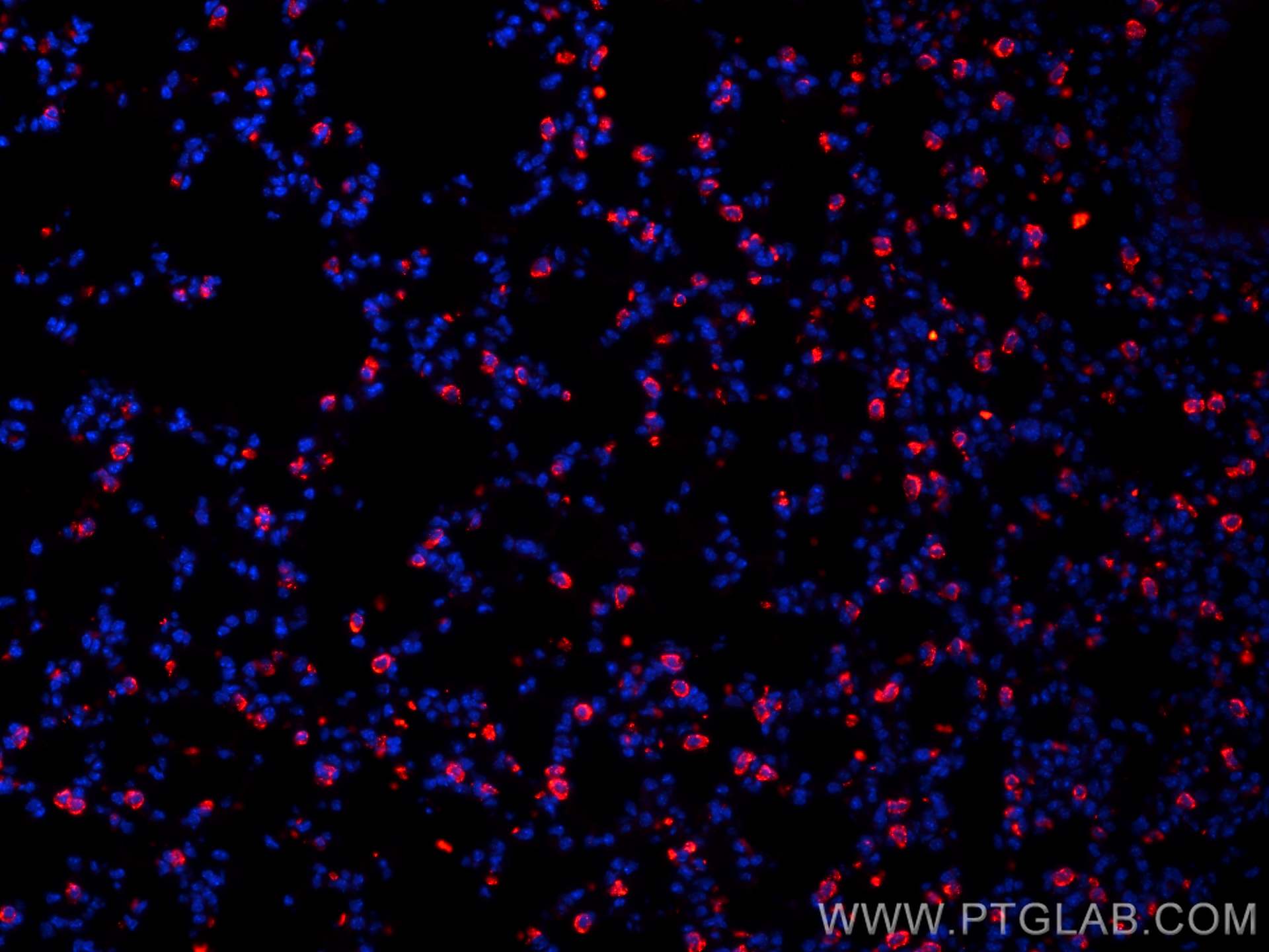 IF Staining of mouse lung using 10774-1-AP