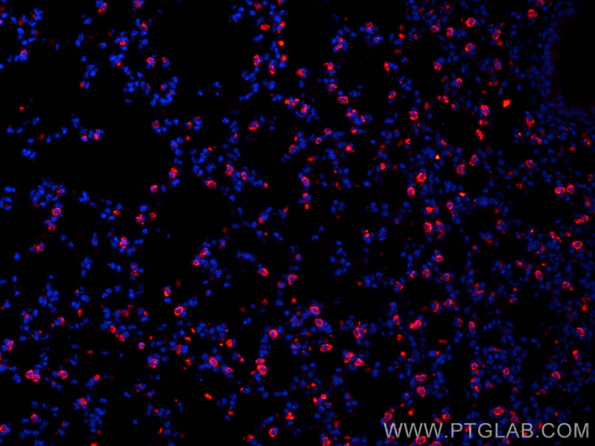 Immunofluorescence (IF) / fluorescent staining of mouse lung tissue using SFTPC Polyclonal antibody (10774-1-AP)