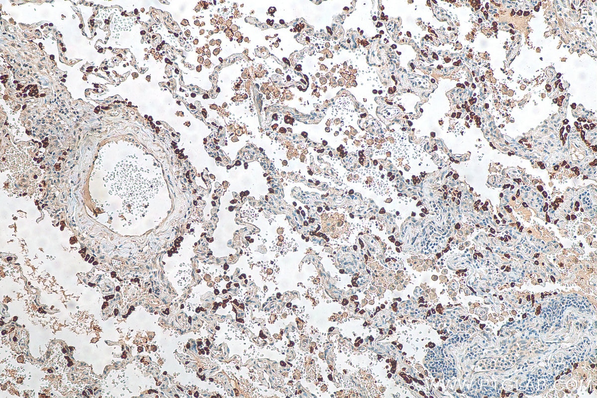 Immunohistochemistry (IHC) staining of human lung tissue using SFTPC Polyclonal antibody (10774-1-AP)