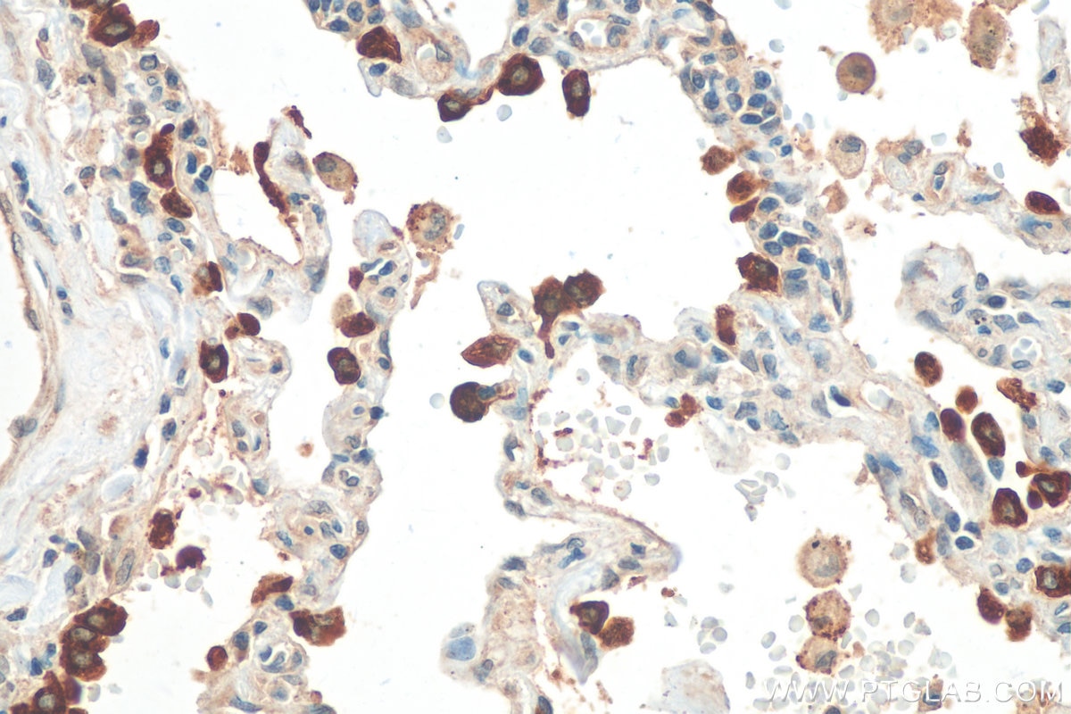 IHC staining of human lung using 10774-1-AP