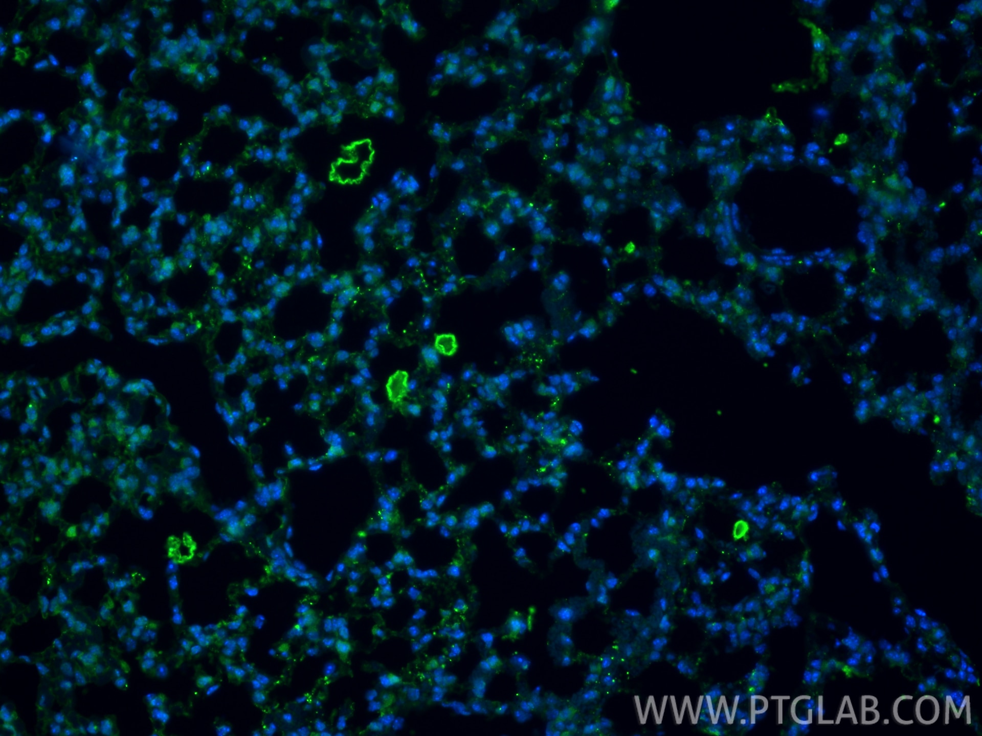 Immunofluorescence (IF) / fluorescent staining of mouse lung tissue using Surfactant protein D Polyclonal antibody (11839-1-AP)