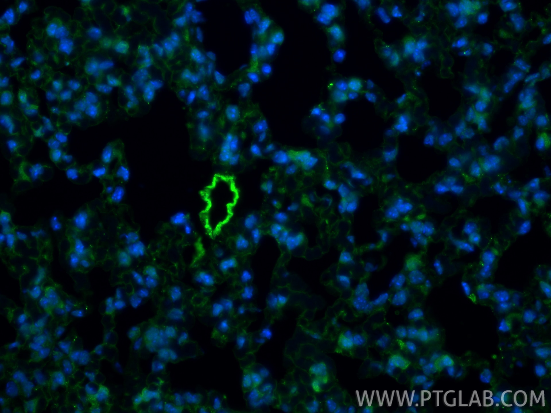 Immunofluorescence (IF) / fluorescent staining of mouse lung tissue using Surfactant protein D Polyclonal antibody (11839-1-AP)