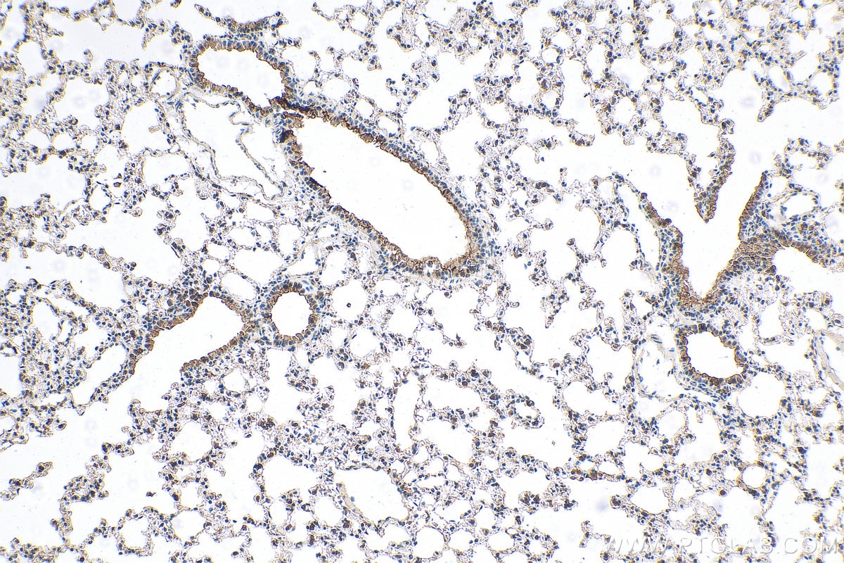 IHC staining of mouse lung using 11839-1-AP