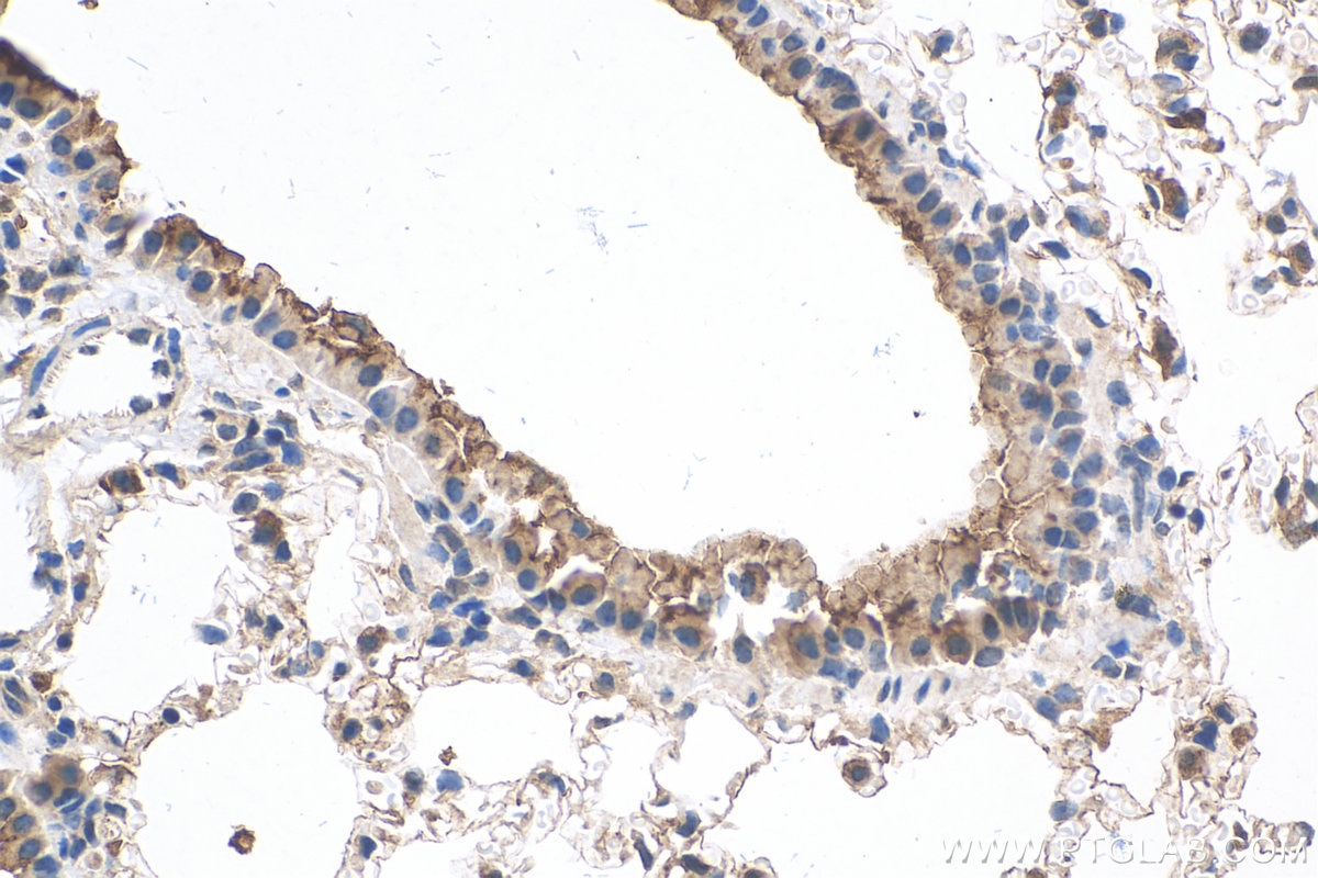 Immunohistochemistry (IHC) staining of mouse lung tissue using Surfactant protein D Polyclonal antibody (11839-1-AP)