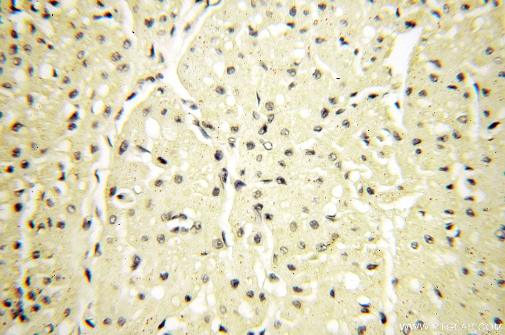 Surfactant protein D