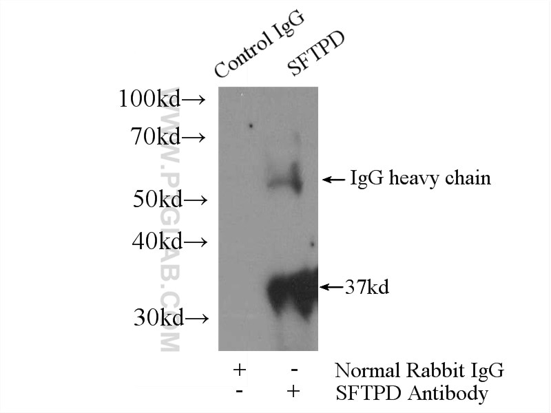 Immunoprecipitation (IP) experiment of mouse lung tissue using Surfactant protein D Polyclonal antibody (11839-1-AP)