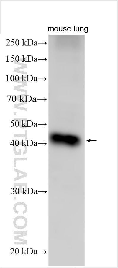 Western Blot (WB) analysis of various lysates using Surfactant protein D Polyclonal antibody (11839-1-AP)