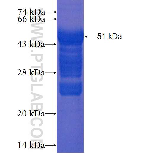SFTPD fusion protein Ag2461 SDS-PAGE