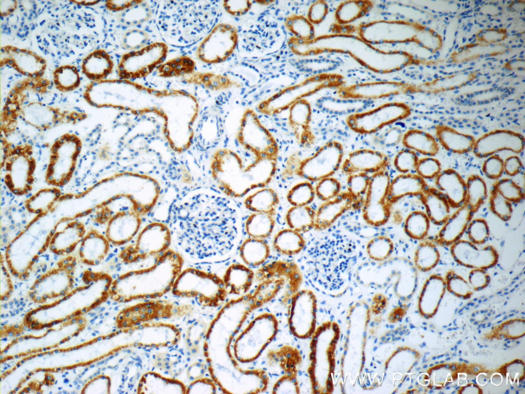 Immunohistochemistry (IHC) staining of human kidney tissue using SFXN1 Polyclonal antibody (12296-1-AP)