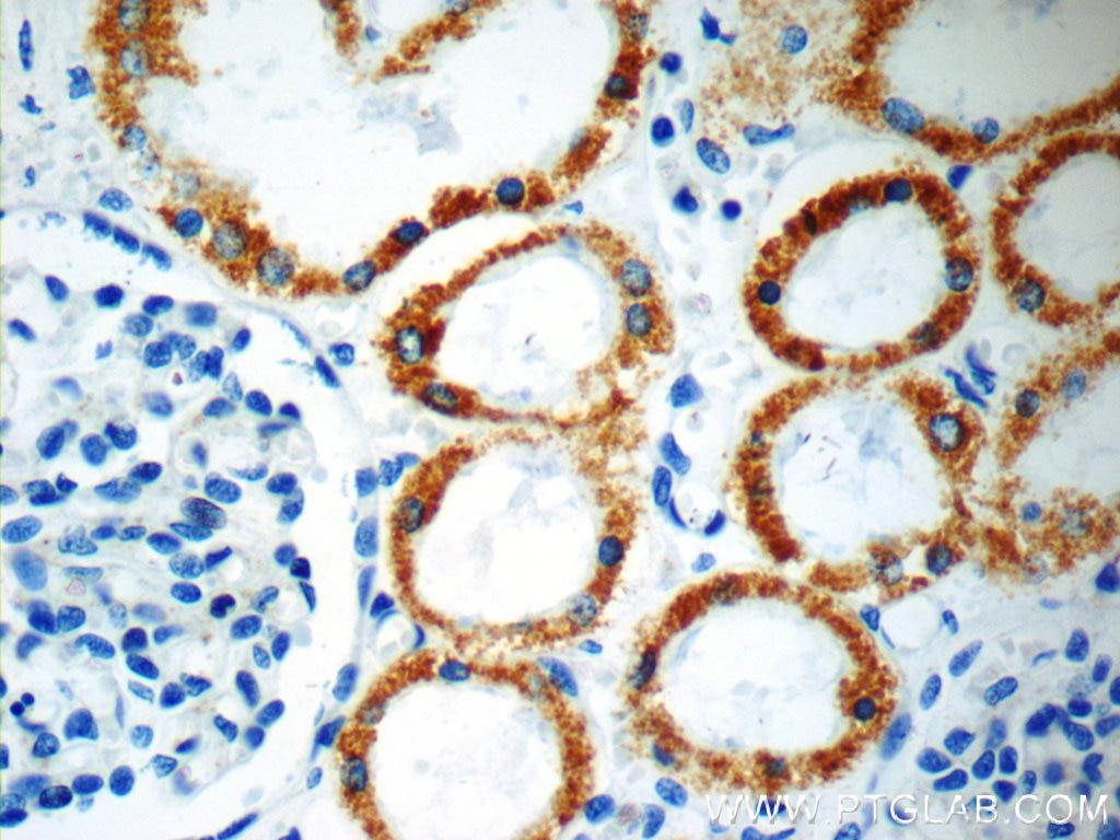 Immunohistochemistry (IHC) staining of human kidney tissue using SFXN1 Polyclonal antibody (12296-1-AP)