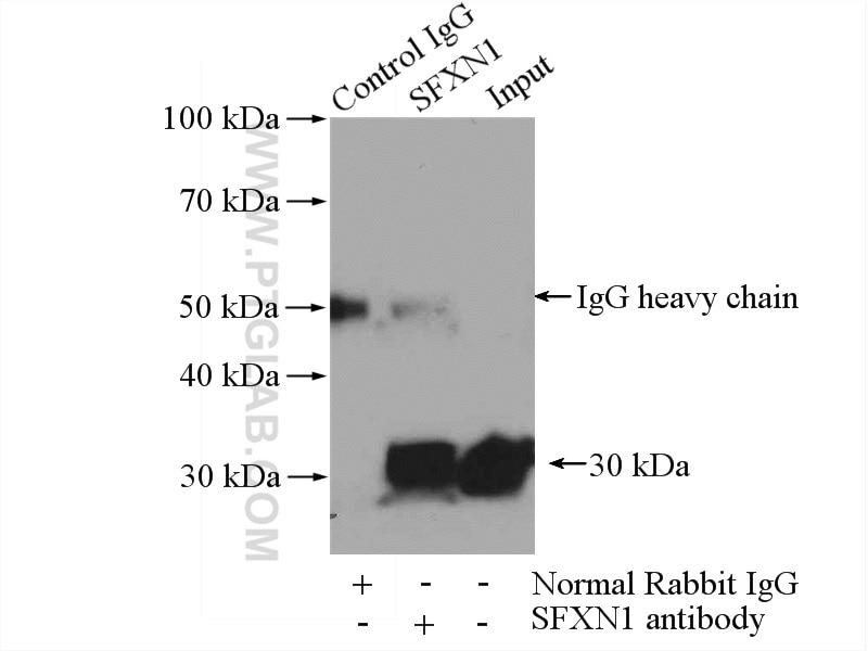 Immunoprecipitation (IP) experiment of mouse brain tissue using SFXN1 Polyclonal antibody (12296-1-AP)