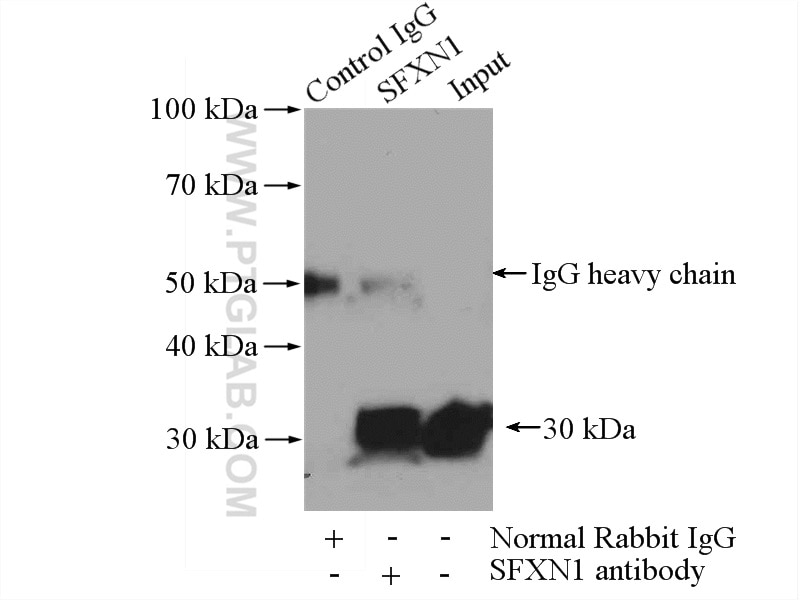 IP experiment of mouse brain using 12296-1-AP