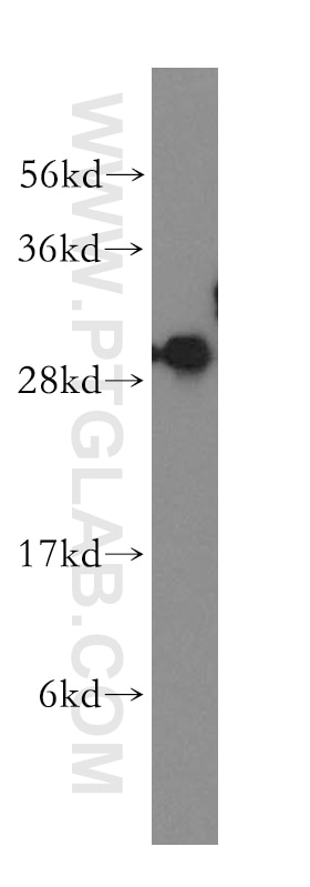 Western Blot (WB) analysis of human brain tissue using SFXN1 Polyclonal antibody (12296-1-AP)