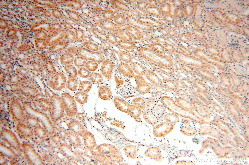Immunohistochemistry (IHC) staining of human kidney tissue using SFXN2 Polyclonal antibody (15985-1-AP)