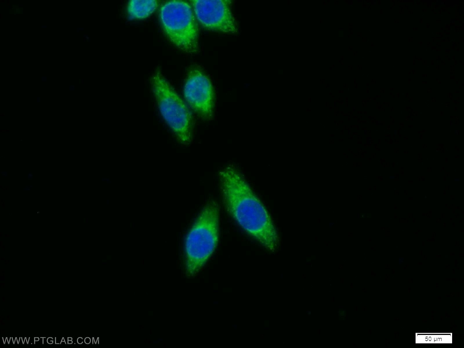 Immunofluorescence (IF) / fluorescent staining of BxPC-3 cells using SFXN3 Polyclonal antibody (15156-1-AP)