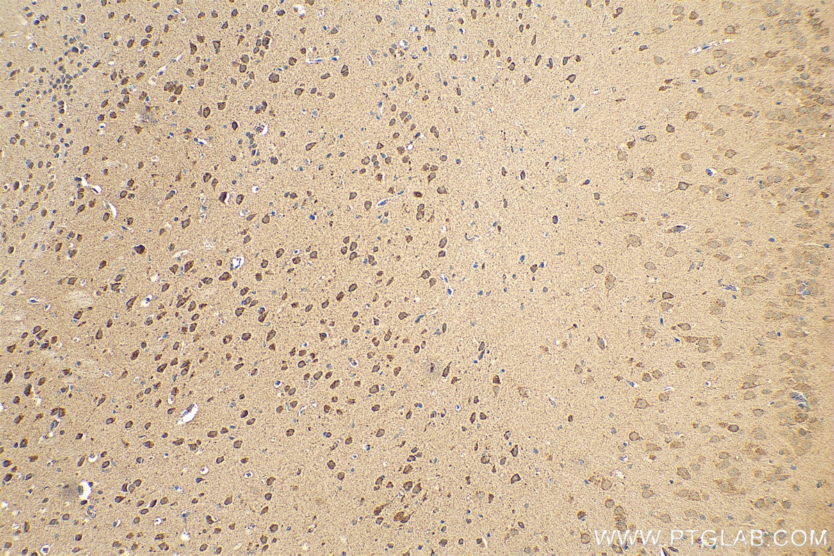 Immunohistochemistry (IHC) staining of mouse brain tissue using SFXN3 Polyclonal antibody (15156-1-AP)