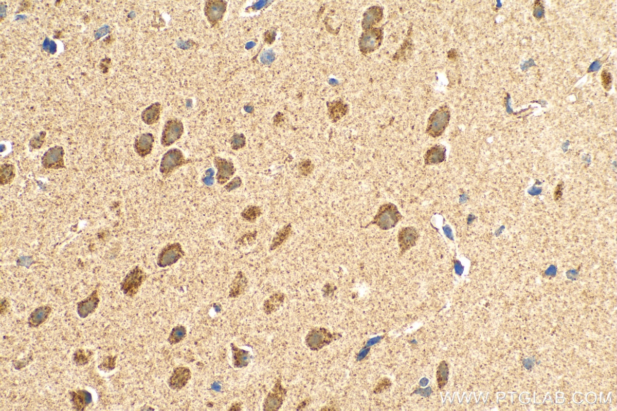 Immunohistochemistry (IHC) staining of mouse brain tissue using SFXN3 Polyclonal antibody (15156-1-AP)