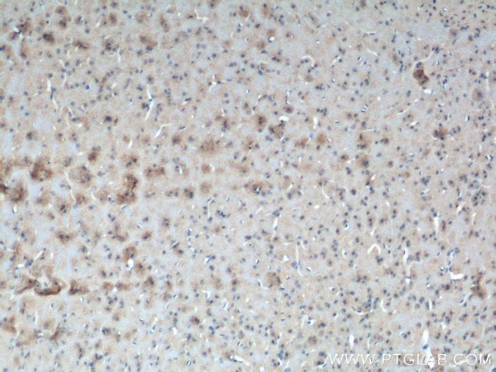 Immunohistochemistry (IHC) staining of mouse brain tissue using SFXN3 Polyclonal antibody (15156-1-AP)