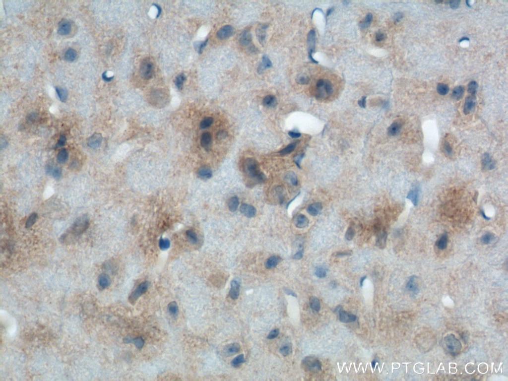 Immunohistochemistry (IHC) staining of mouse brain tissue using SFXN3 Polyclonal antibody (15156-1-AP)