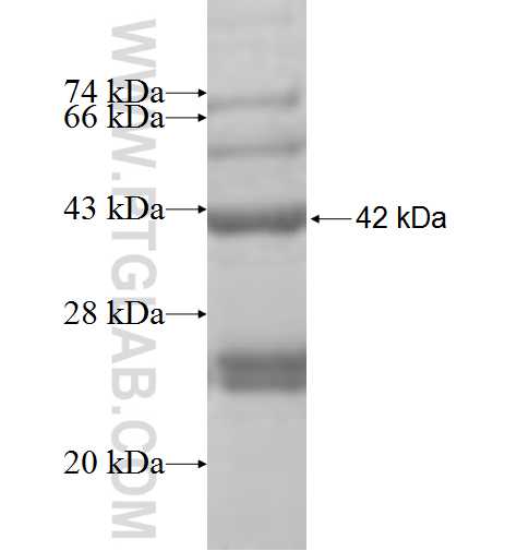 SFXN3 fusion protein Ag7203 SDS-PAGE