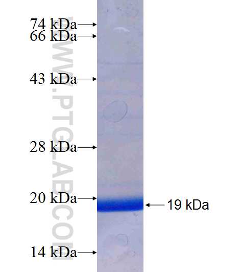 SFXN3 fusion protein Ag7310 SDS-PAGE