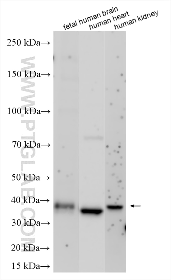 Western Blot (WB) analysis of various lysates using SFXN4 Polyclonal antibody (17647-1-AP)