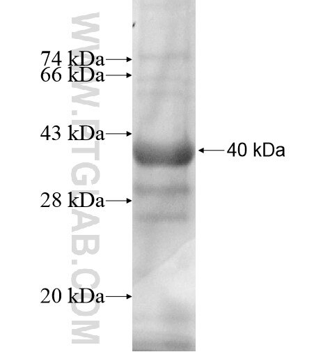 SFXN4 fusion protein Ag11864 SDS-PAGE