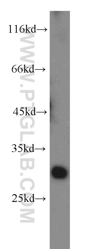 Western Blot (WB) analysis of human skeletal muscle tissue using Alpha Sarcoglycan Polyclonal antibody (13222-1-AP)
