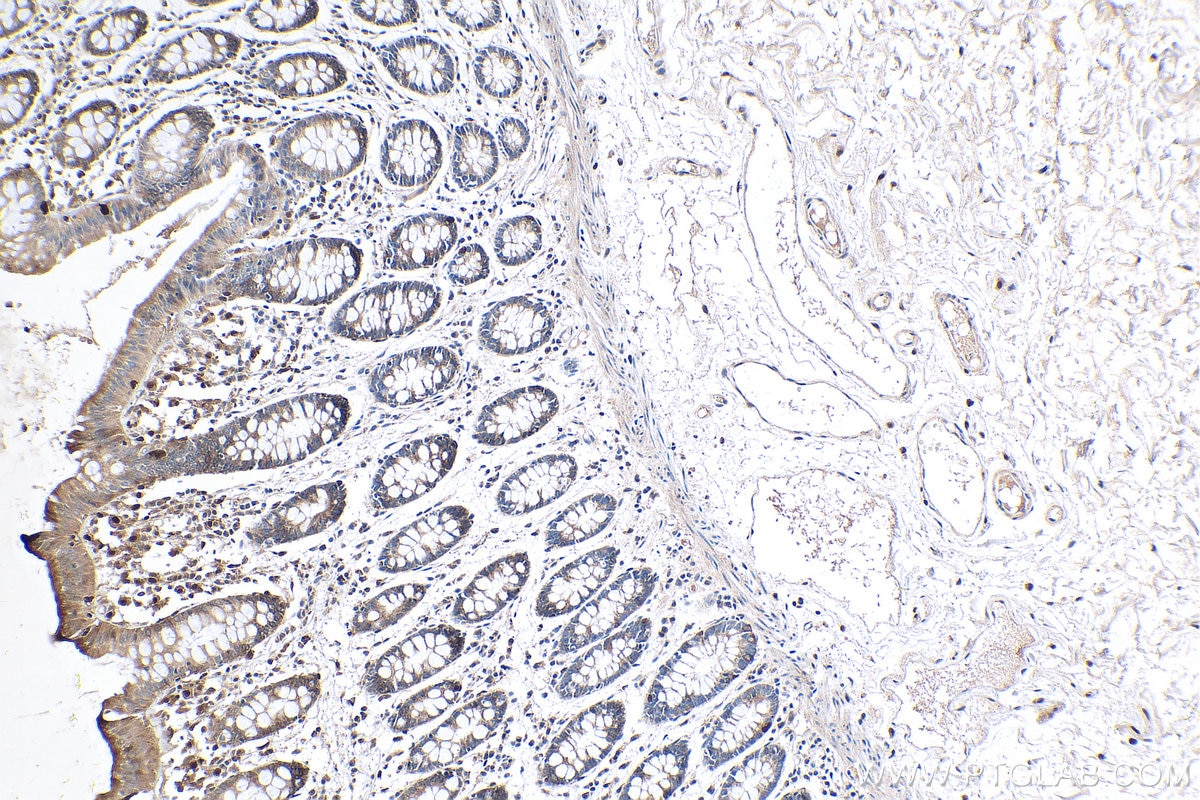 Immunohistochemistry (IHC) staining of human colon tissue using Beta Sarcoglycan Polyclonal antibody (11936-1-AP)