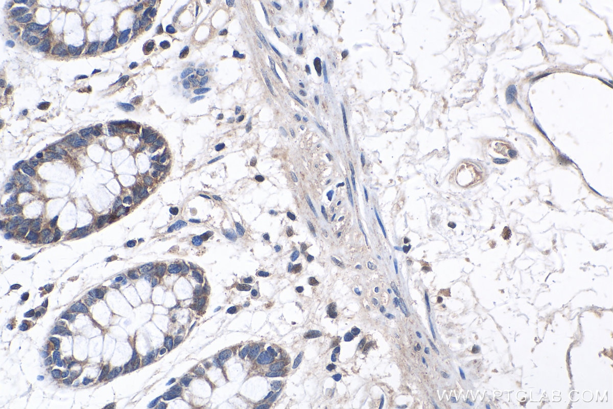 Immunohistochemistry (IHC) staining of human colon tissue using Beta Sarcoglycan Polyclonal antibody (11936-1-AP)