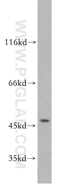 Beta Sarcoglycan