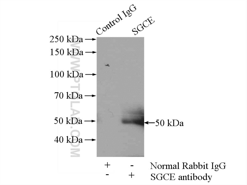 Immunoprecipitation (IP) experiment of mouse heart tissue using SGCE Polyclonal antibody (12407-1-AP)