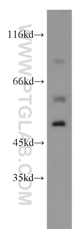 Western Blot (WB) analysis of mouse brain tissue using SGCE Polyclonal antibody (12407-1-AP)