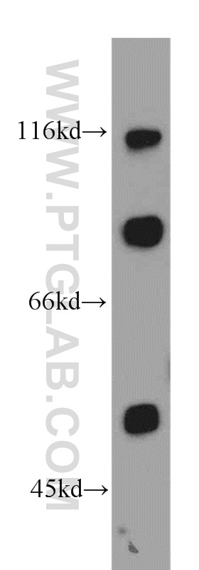Western Blot (WB) analysis of mouse heart tissue using SGCE Polyclonal antibody (12407-1-AP)