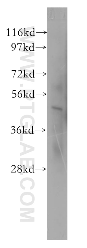 Western Blot (WB) analysis of human brain tissue using SGCE Polyclonal antibody (12407-1-AP)